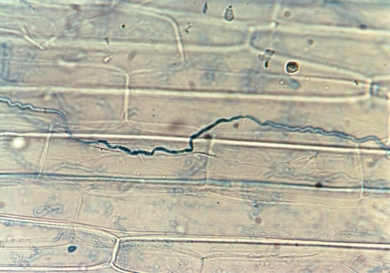 endophyte